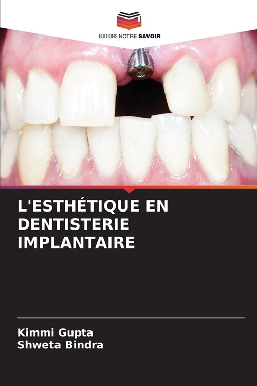 LEsth?ique En Dentisterie Implantaire (Paperback)