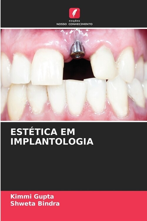 Est?ica Em Implantologia (Paperback)