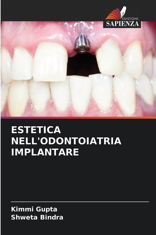Estetica Nellodontoiatria Implantare (Paperback)