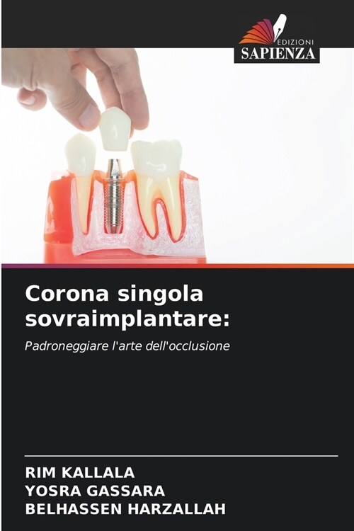 Corona singola sovraimplantare (Paperback)