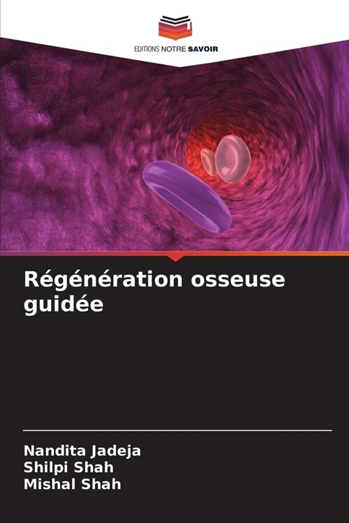 R???ation osseuse guid? (Paperback)