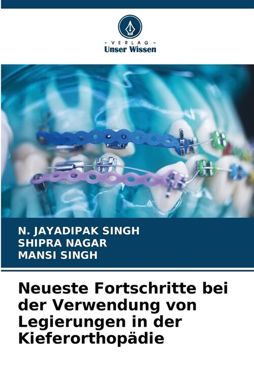 Neueste Fortschritte bei der Verwendung von Legierungen in der Kieferorthop?ie (Paperback)