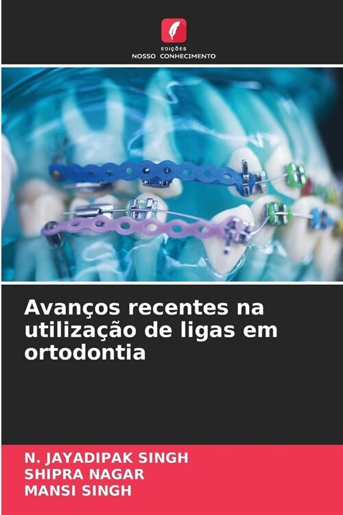 Avan?s recentes na utiliza豫o de ligas em ortodontia (Paperback)