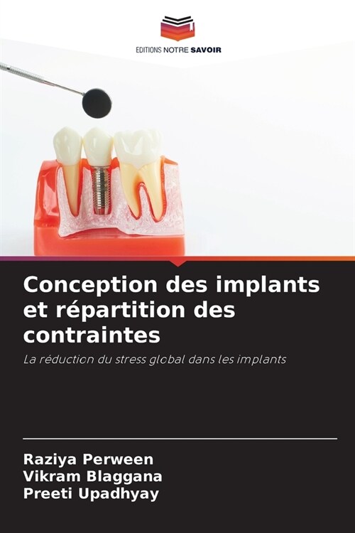 Conception des implants et r?artition des contraintes (Paperback)