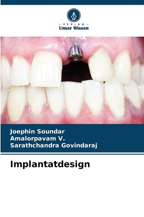 Implantatdesign (Paperback)