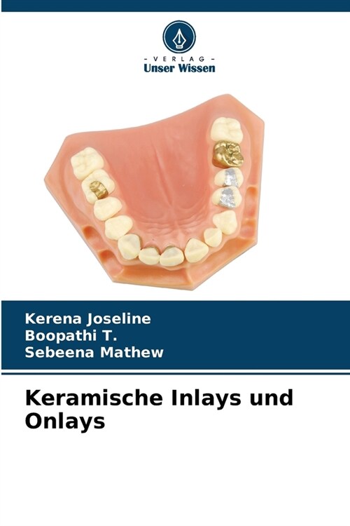 Keramische Inlays und Onlays (Paperback)