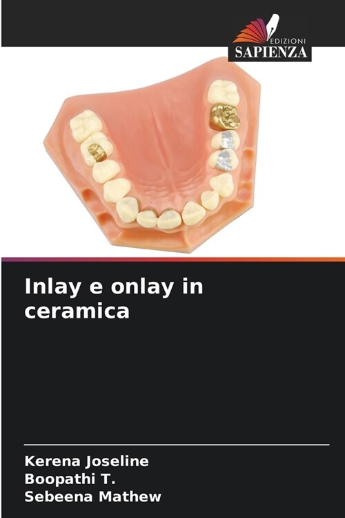 Inlay e onlay in ceramica (Paperback)