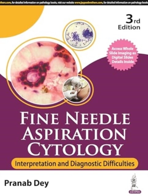 Fine Needle Aspiration Cytology : Interpretation and Diagnostic Difficulties (Paperback, 3 Revised edition)