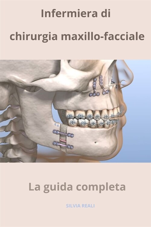 Infermiera di chirurgia maxillo-facciale - La guida completa (Paperback)