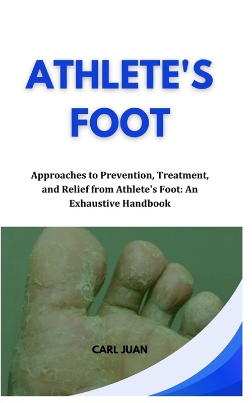 Athletes Foot: Approaches to Prevention, Treatment, and Relief from Athletes Foot: An Exhaustive Handbook (Paperback)