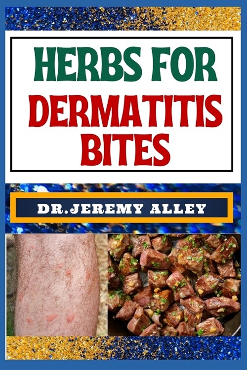 Herbs for Dermatitis Bites: Natures Soothing Solutions: Unlocking The Power To Conquer Insect Disease Naturally (Paperback)