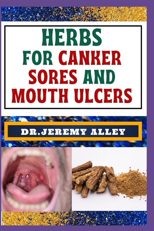 Herbs for Canker Sores and Mouth Ulcers: Soothing Remedies, Harnessing Wisdom To Relieve Natures Bounty Through Effective Strategies (Paperback)