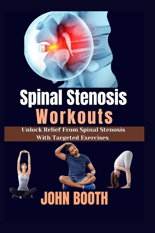 Spinal Stenosis Workouts: Unlock relief from spinal stenosis with targeted exercises (Paperback)