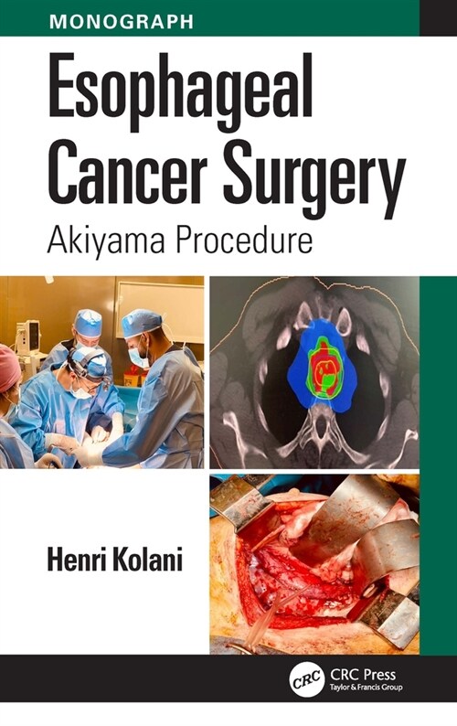 Esophageal Cancer Surgery : Akiyama Procedure (Paperback)