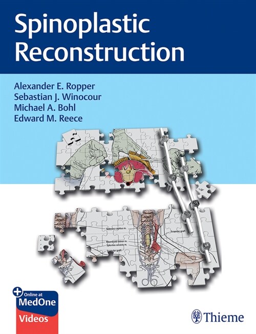 Spinoplastic Reconstruction (Hardcover)