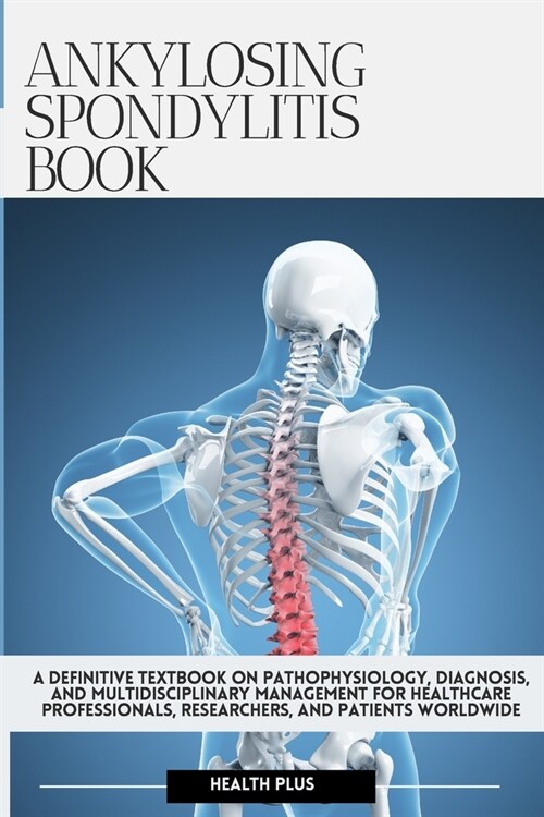 Ankylosing Spondylitis Book: A Definitive Textbook on Pathophysiology, Diagnosis, and Multidisciplinary Management for Healthcare Professionals, Re (Paperback)