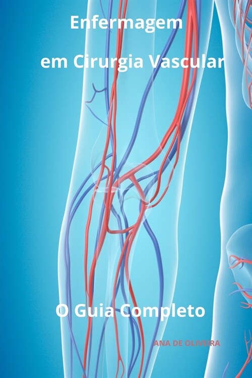 Enfermagem em Cirurgia Vascular O Guia Completo (Paperback)