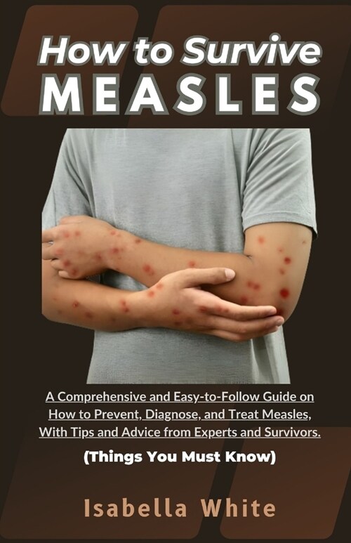How to Survive Measles: A Comprehensive and Easy-to-Follow Guide on How to Prevent, Diagnose, and Treat Measles, With Tips and Advice from Exp (Paperback)