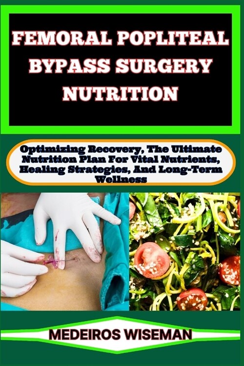 Femoral Popliteal Bypass Surgery Nutrition: Optimizing Recovery, The Ultimate Nutrition Plan For Vital Nutrients, Healing Strategies, And Long-Term We (Paperback)