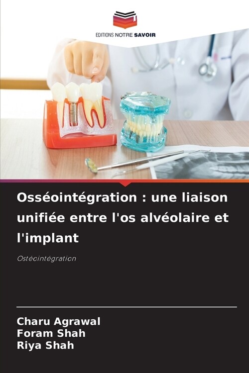 Oss?int?ration: une liaison unifi? entre los alv?laire et limplant (Paperback)