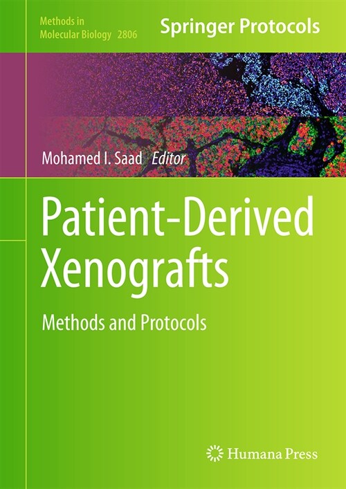 Patient-Derived Xenografts: Methods and Protocols (Hardcover, 2024)