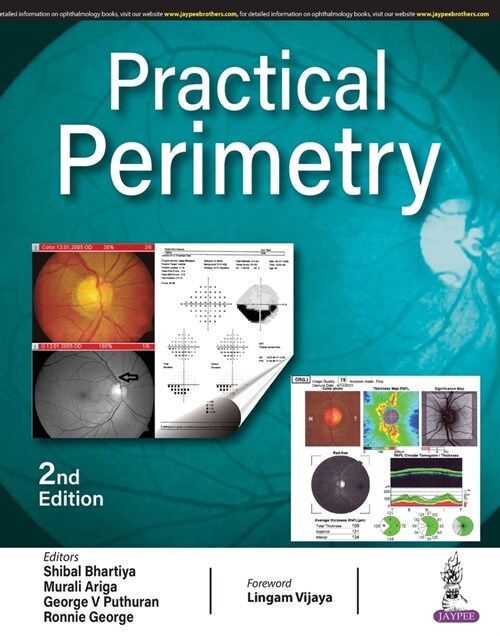 Practical Perimetry (Paperback, 2 Revised edition)