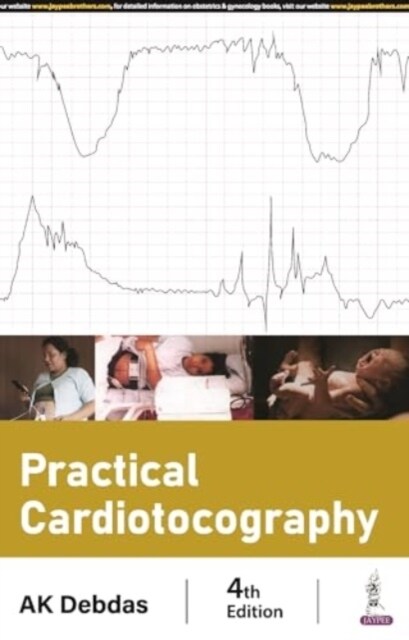 Practical Cardiotocography (Paperback, 4 Revised edition)