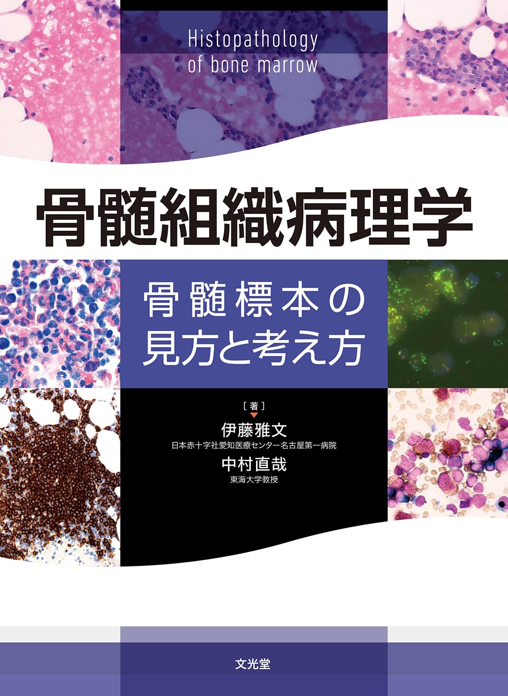 骨髓組織病理學 骨髓標本の見方と考え方