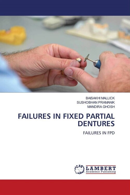 FAILURES IN FIXED PARTIAL DENTURES (Paperback)