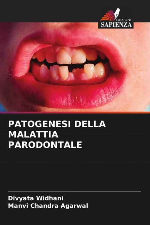 PATOGENESI DELLA MALATTIA PARODONTALE (Paperback)