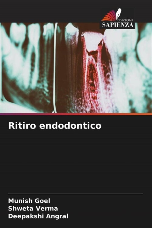 Ritiro endodontico (Paperback)