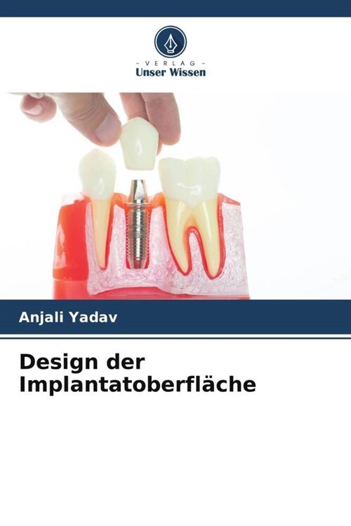 Design der Implantatoberflache (Paperback)