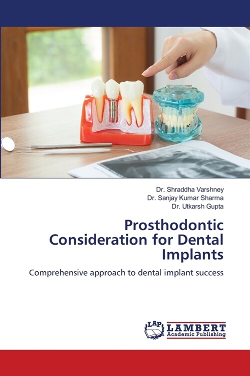 Prosthodontic Consideration for Dental Implants (Paperback)