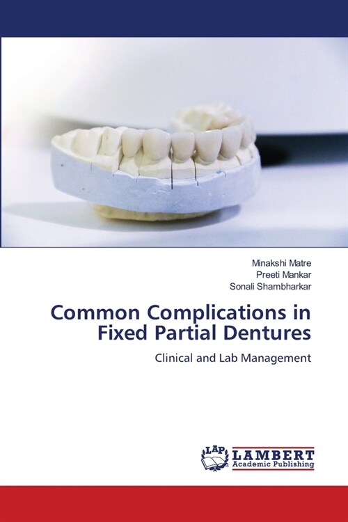 Common Complications in Fixed Partial Dentures (Paperback)