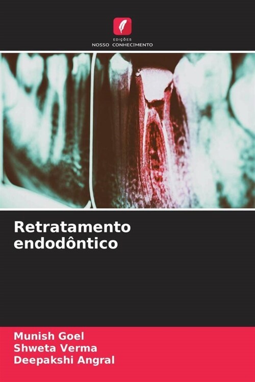 Retratamento endodontico (Paperback)