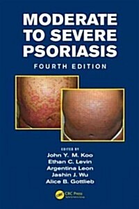 Moderate to Severe Psoriasis (Hardcover, 4)