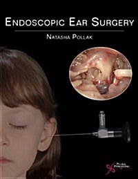 Endoscopic Ear Surgery (Paperback)