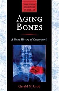 Aging Bones: A Short History of Osteoporosis (Paperback)