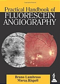 Practical Handbook of Fluorescein Angiography (Paperback)