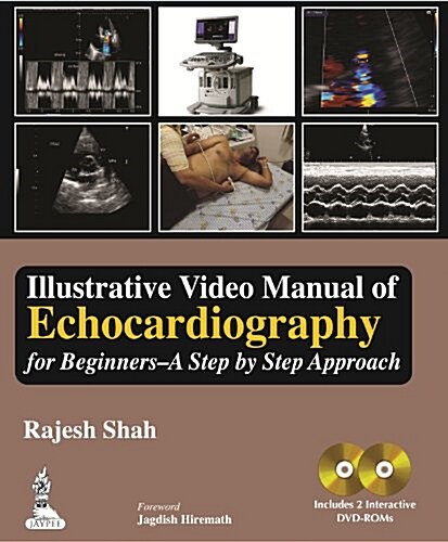 Illustrative Video Manual of Echocardiography for Beginners (Hardcover)