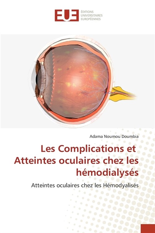 Les Complications et Atteintes oculaires chez les h?odialys? (Paperback)