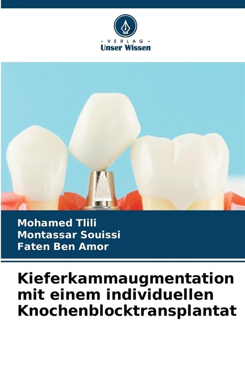 Kieferkammaugmentation mit einem individuellen Knochenblocktransplantat (Paperback)