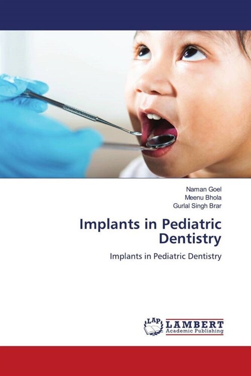 Implants in Pediatric Dentistry (Paperback)