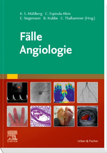 Falle Angiologie (Paperback)