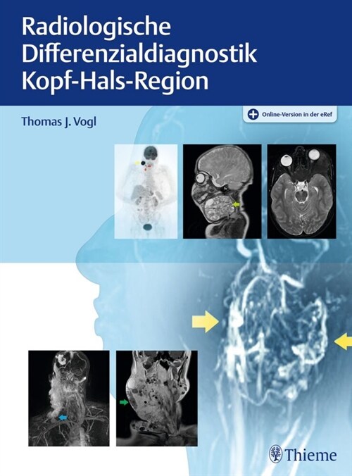 Radiologische Differenzialdiagnostik Kopf-Hals-Region (WW)