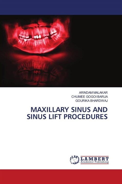 MAXILLARY SINUS AND SINUS LIFT PROCEDURES (Paperback)