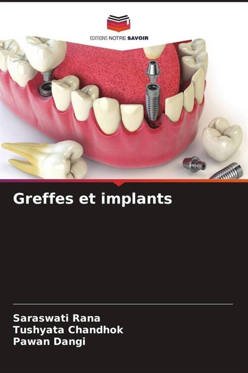 Greffes et implants (Paperback)