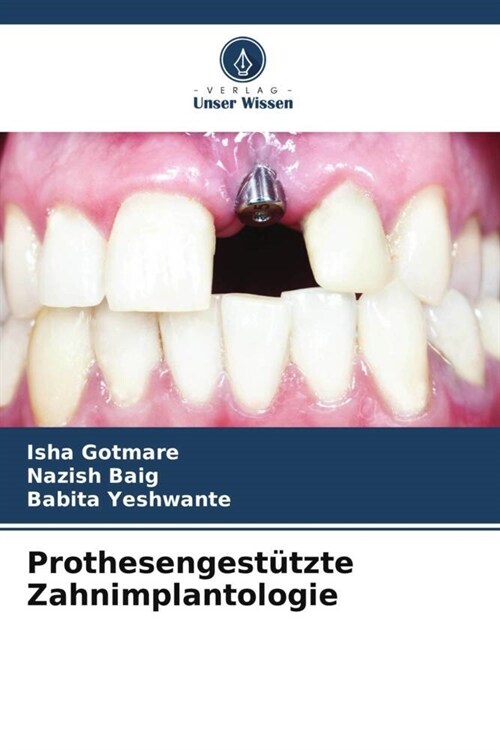 Prothesengest?zte Zahnimplantologie (Paperback)