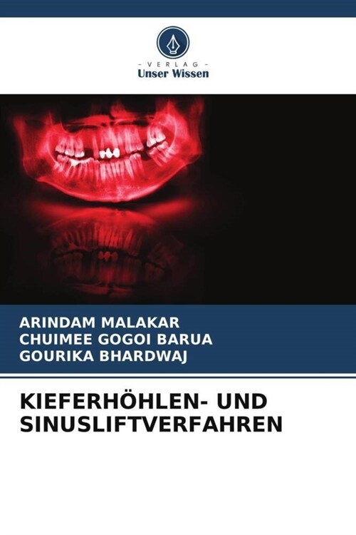 KIEFERHOHLEN- UND SINUSLIFTVERFAHREN (Paperback)