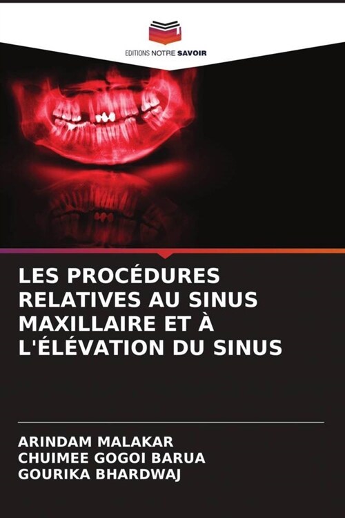 LES PROCEDURES RELATIVES AU SINUS MAXILLAIRE ET A LELEVATION DU SINUS (Paperback)